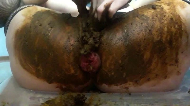 Toilet Anal Prolapse In Shit [FullHD] (2021)
