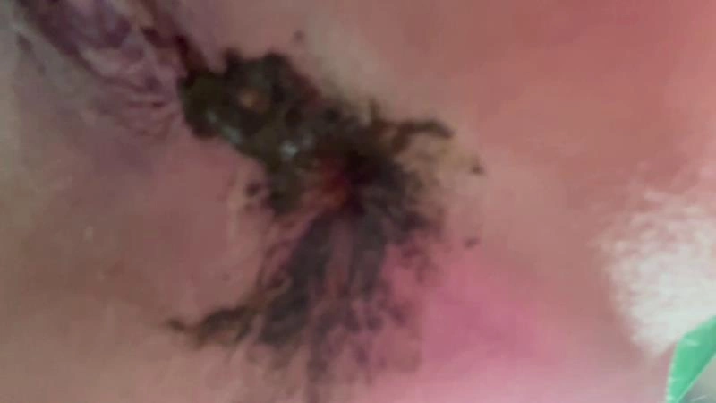 thefartbabes - My Poop Lover [FullHD] (2025)